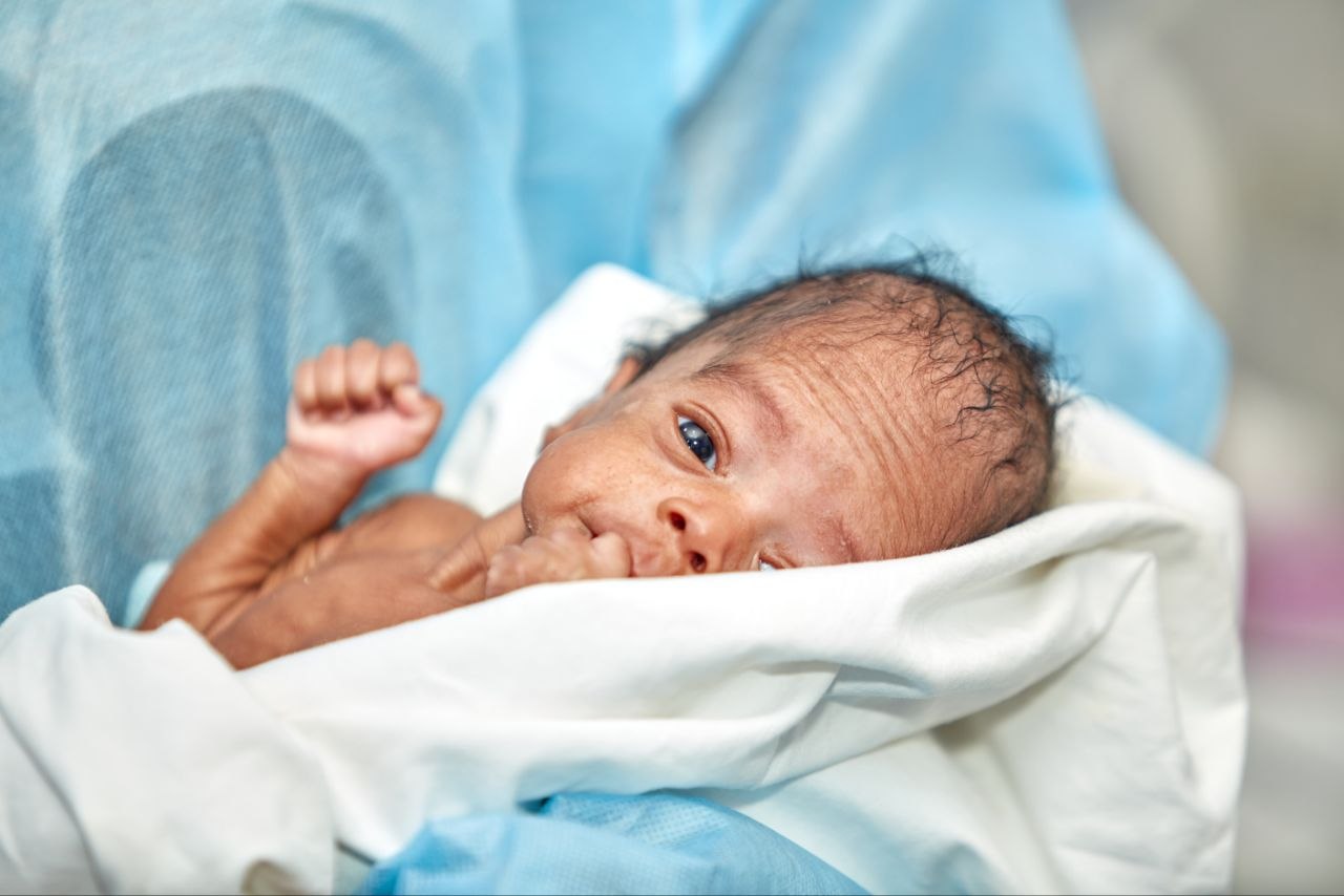 A young child resting peacefully while receiving medical oxygen at Maamobi Children's Ward in Accra